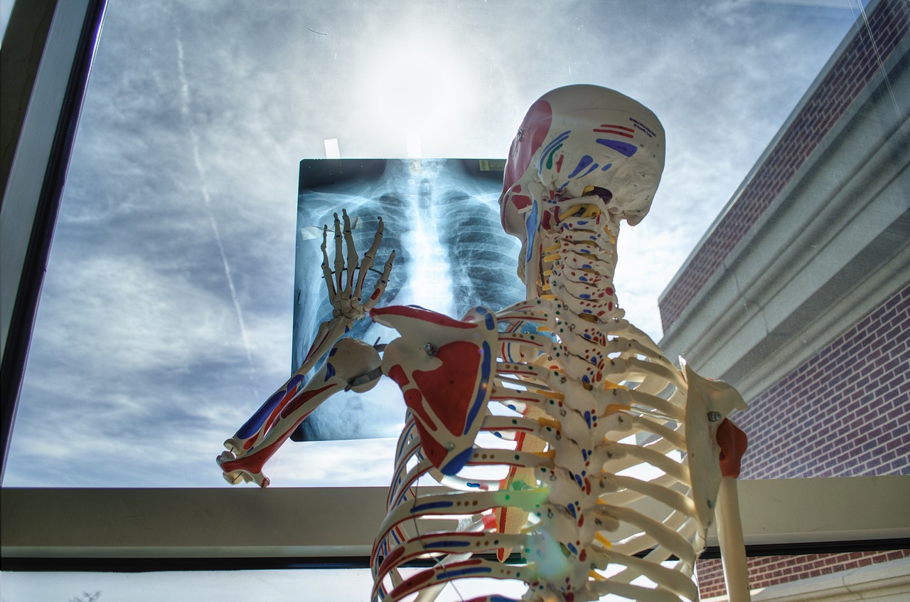 De dos et face à la grande fenêtre d'un bâtiment médical, un squelette de salle de sciences touche la radio d'une cage thoracique scotchée sur la vitre. Le soleil passe à travers la feuille et à travers le squelette sur lequel des points de repères bleus et rouges sont apposés.